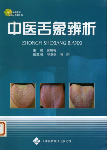 《中医舌象辨析》91页插图 《中医舌象辨析》91页插图